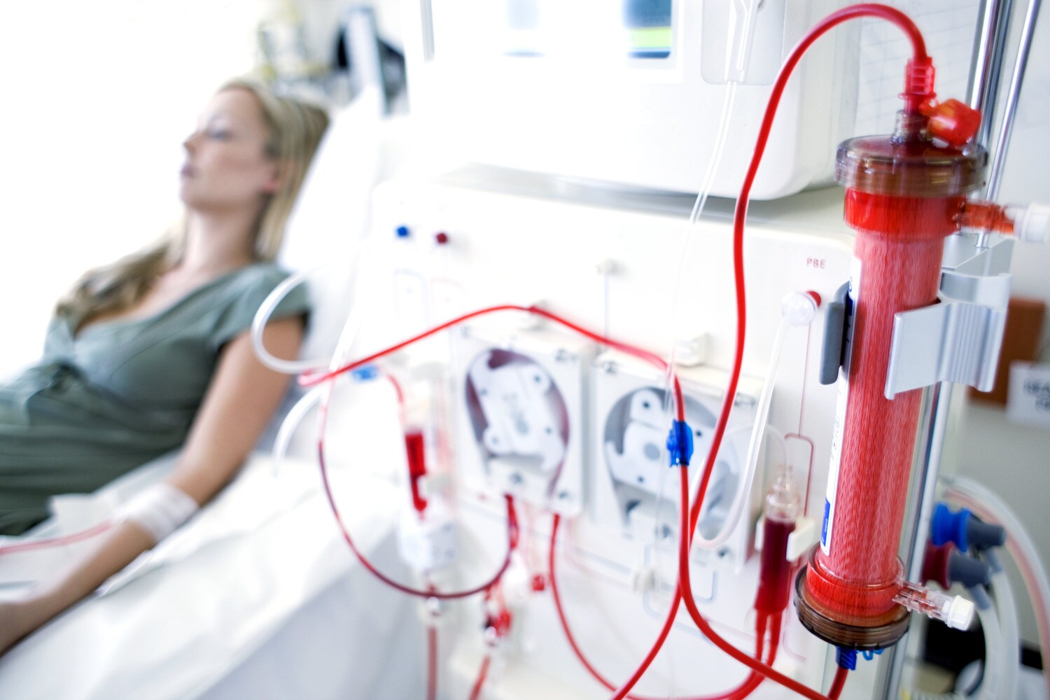 Le infezioni del sangue correlate al catetere (CR-BSI) in Emodialisi.