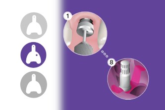 Video della tecnica n. 2 - Impronta con prelievo diretto a cucchiaio aperto
