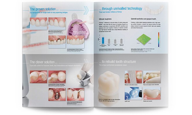 Anteprima brochure Materiale per provvisori 3M Protemp 4
