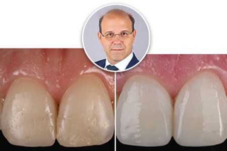anteprima caso clinico
