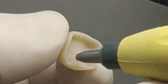 Come sabbiare un dente
