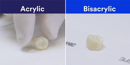 Perché scegliere il materiale bis-acrilico?
