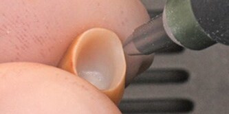 La superficie di adesione della corona è insabbiata con ossido di alluminio.
