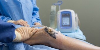 Ginocchio di un paziente con terapia della ferita a pressione negativa
