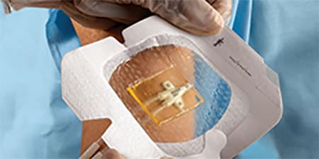 3M™ Tegaderm™ CHG  Protezione antimicrobica
