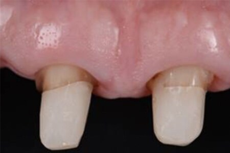 Denti in primo piano
