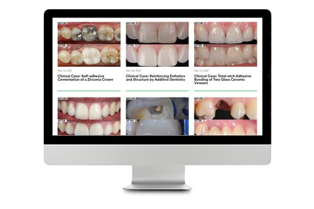Computer che mostra casi clinici odontoiatrici
