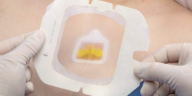 Applicazione della medicazione Tegaderm Port .
