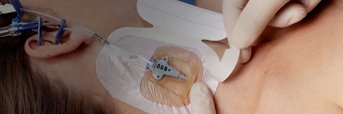 3M™ Tegaderm™ CHG medicazione di fissaggio IV con Clorexidina Gluconata
