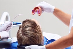 L'impronta viene presa da un dentista