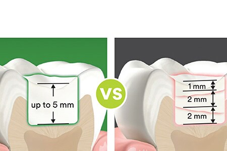 Confronto tra compositi bulk-fill
