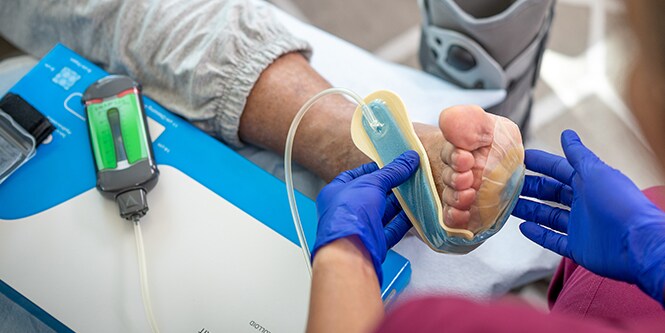 Medico che utilizza il sistema terapeutico Snap per trattare un paziente con la NPWT
