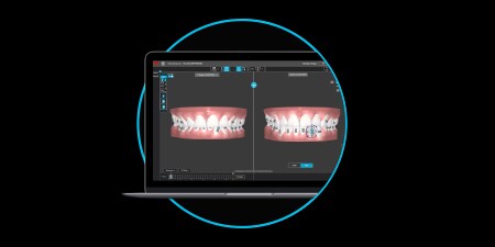 Laptop che utilizza l'Oral Care Portal 3M.
