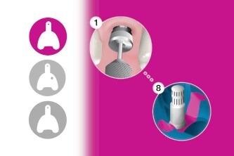 Video della tecnica n. 1 - Impronta a trasferimento indiretto a cucchiaio chiuso
