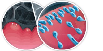 Immagini di tessuto della ferita e medicazione con formazione di tessuto di granulazione
