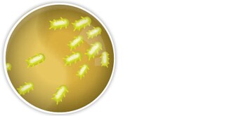 Immagine dell'essudato e del materiale infetto di una ferita
