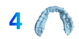 Registrazione occlusale

