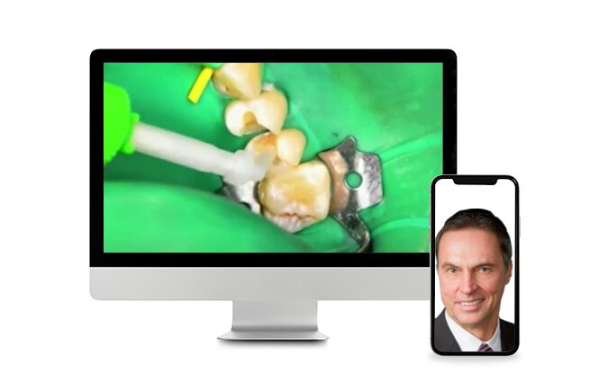 Webinar sulla cementazione e l'adesione dei materiali dentali
