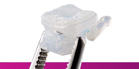 Closeup of dental bracket held by dentist tool

