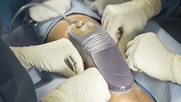 Immagine di un paziente a casa con una medicazione prevena
