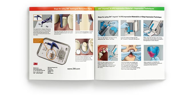 Guida per l'operatore alle impronte con 3M Imprint 4
