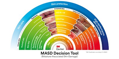 Immagine che mostra come funziona lo strumento per identificare le MASD
