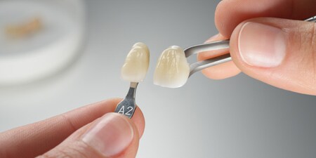 Comparazione gradazione del dente
