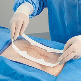 Un chirurgo applica una medicazione trasparente ad un'incisione chirurgica