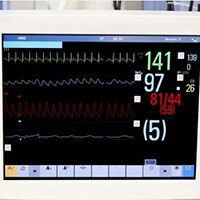 Allarmi del monitoraggio ECG