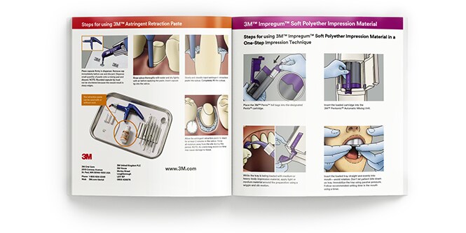 Guida per l'operatore alle impronte con 3M Impregum
